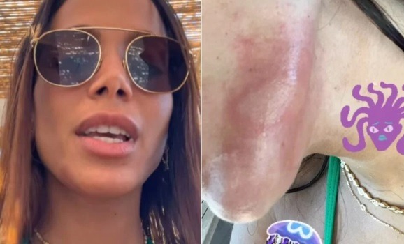 Anitta