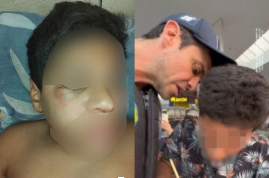 agressão