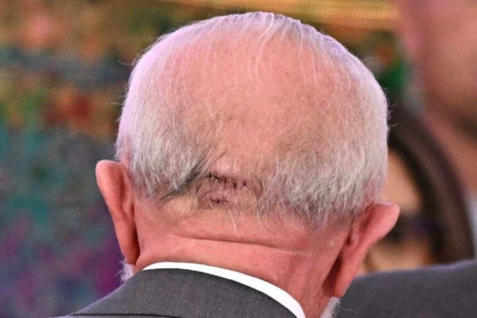 1_2d058e83dcfdb6fc2e50ac6185445fab77610157w_768x512_42794339a-42842106