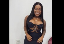 Jojo Todynho fala sobre recuperação pós-cirurgia: “Está muito inchado”