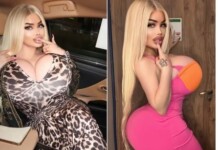 Influenciadora holandesa diz que pagou R$ 2 milhões por ‘bumbum brasileiro’ e quase morreu