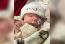 Bebê nasce com síndrome rara, sem olho e com orelha na bochecha