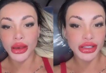 Andressa Urach aparece com a boca gigante e dá aula para homens: ‘Feio, barrigudo, velho’