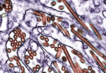 Criança morre no México após infecção por H5N1, diz governo