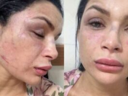 Musa de escola de samba é agredida em emboscada durante corrida por aplicativo em Manaus