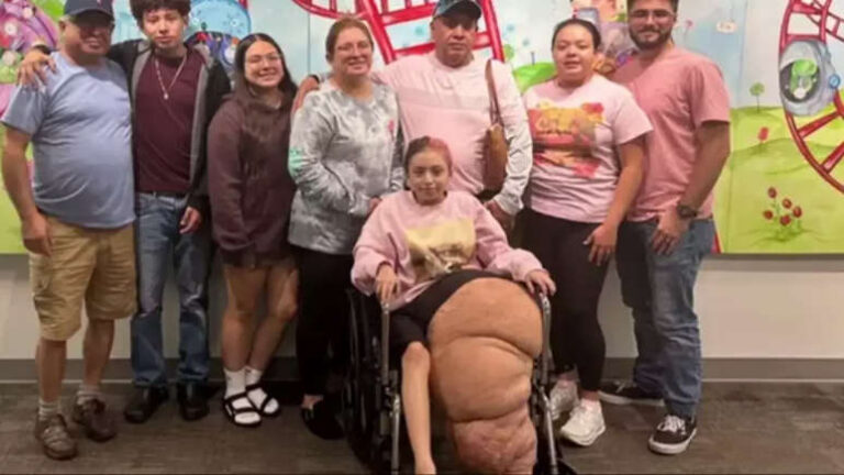 Menina passa por cirurgia de 17 horas para amputar uma perna de cerca de 77 quilos