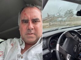 Pré-candidato à Presidência do Peru sofre ataque a tiros