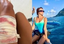 Mulher é atacada por tubarão durante mergulho em Fernando de Noronha