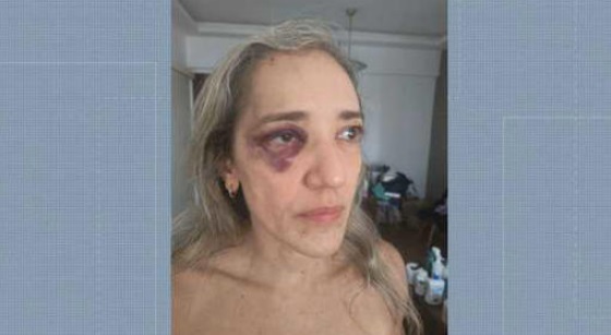 agressão