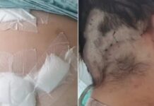 Mulher é mantida em cárcere, t0rturada e atingid@ pelo ex com 12 facad@s: ‘fingi que estava m0rta’